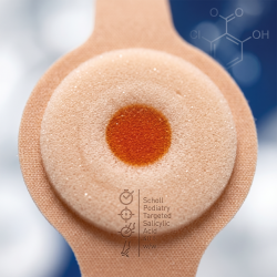 Et utroligt skarpt og detaljeret n�rbillede af et medicinsk fodplaster med en bl�d, polstret ring i midten. Ringen har en svag, klinisk farvetone, der symboliserer den aktive syre. Plasteret ligger p� en ren, klinisk hvid og svag bl� baggrund.